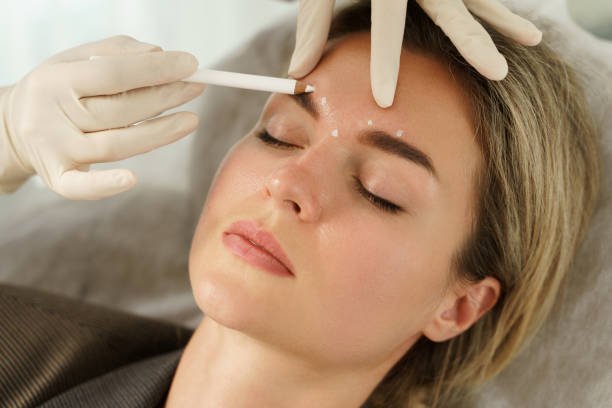 Botox Prices in 2026: UK Cost Guide