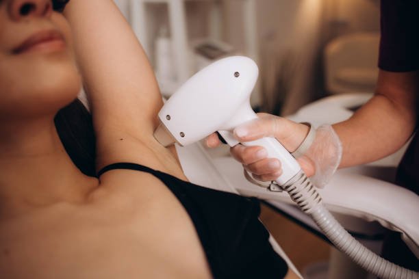 Laser Hair Removal Prices in 2026: UK Cost Guide